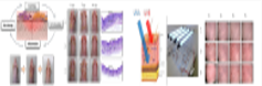 Evaluation of dental convergence device
